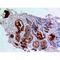 Angiopoietin 1 antibody, LS-C387136, Lifespan Biosciences, Immunohistochemistry paraffin image 