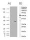 SWI/SNF Related, Matrix Associated, Actin Dependent Regulator Of Chromatin, Subfamily E, Member 1 antibody, PA5-18185, Invitrogen Antibodies, Western Blot image 