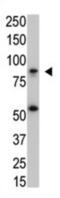 Inhibitor Of Nuclear Factor Kappa B Kinase Subunit Beta antibody, abx025556, Abbexa, Western Blot image 