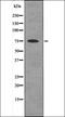 Protein Kinase C Gamma antibody, orb336065, Biorbyt, Western Blot image 