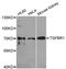 Transforming Growth Factor Beta Receptor 1 antibody, abx004991, Abbexa, Western Blot image 