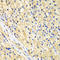 Nucleoporin 62 antibody, LS-C332119, Lifespan Biosciences, Immunohistochemistry paraffin image 
