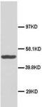 DnaJ Heat Shock Protein Family (Hsp40) Member B1 antibody, PA5-79162, Invitrogen Antibodies, Western Blot image 