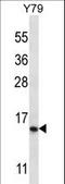 Nuclear Receptor 2C2 Associated Protein antibody, LS-C162990, Lifespan Biosciences, Western Blot image 