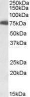 USH1 Protein Network Component Harmonin antibody, PA1-31347, Invitrogen Antibodies, Western Blot image 