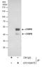 CCAAT Enhancer Binding Protein Beta antibody, GTX100675, GeneTex, Immunoprecipitation image 