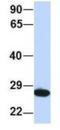 Proteasome Subunit Alpha 2 antibody, NBP1-54633, Novus Biologicals, Western Blot image 