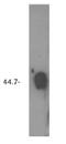 Sphingosine-1-phosphate phosphatase 2 antibody, AP05170PU-N, Origene, Western Blot image 