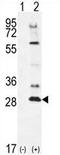 Testis Specific Serine Kinase 4 antibody, AP54389PU-N, Origene, Western Blot image 