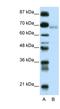 Zinc Finger And BTB Domain Containing 22 antibody, NBP1-80113, Novus Biologicals, Western Blot image 
