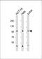 Mannosidase Beta antibody, 61-340, ProSci, Western Blot image 