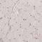 Nuclear Receptor Coactivator 3 antibody, NBP1-90256, Novus Biologicals, Immunohistochemistry paraffin image 