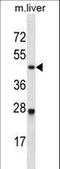 Cyclin Dependent Kinase 2 antibody, LS-C164331, Lifespan Biosciences, Western Blot image 