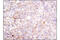 Integrin Subunit Beta 1 antibody, 9699S, Cell Signaling Technology, Immunohistochemistry paraffin image 