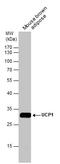 Uncoupling Protein 1 antibody, GTX131207, GeneTex, Western Blot image 