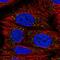 Acetoacetyl-CoA Synthetase antibody, HPA058815, Atlas Antibodies, Immunofluorescence image 