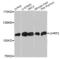 Ubiquitin Like With PHD And Ring Finger Domains 2 antibody, orb137038, Biorbyt, Western Blot image 