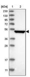 Serpin Family B Member 7 antibody, NBP1-82782, Novus Biologicals, Western Blot image 