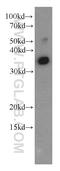 L-lactate dehydrogenase A chain antibody, 21799-1-AP, Proteintech Group, Western Blot image 