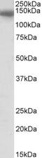 CCAAT Enhancer Binding Protein Zeta antibody, EB11829, Everest Biotech, Western Blot image 