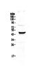 Cellular Communication Network Factor 3 antibody, PA5-79750, Invitrogen Antibodies, Western Blot image 