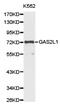 Growth Arrest Specific 2 Like 1 antibody, LS-C192957, Lifespan Biosciences, Western Blot image 