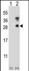 Kallikrein Related Peptidase 7 antibody, PA5-72459, Invitrogen Antibodies, Western Blot image 