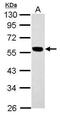 Keratin 7 antibody, PA5-34764, Invitrogen Antibodies, Western Blot image 