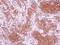 Cell Death Inducing DFFA Like Effector C antibody, NBP2-15903, Novus Biologicals, Immunohistochemistry paraffin image 