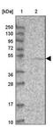 Amylase Alpha 1C (Salivary) antibody, NBP2-46735, Novus Biologicals, Western Blot image 