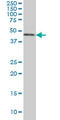 Casein Kinase 1 Gamma 1 antibody, LS-C133766, Lifespan Biosciences, Western Blot image 
