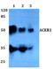 Alkaline Ceramidase 1 antibody, A12775-1, Boster Biological Technology, Western Blot image 