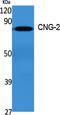 CNGA2 antibody, A07901, Boster Biological Technology, Western Blot image 