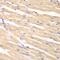 Dickkopf WNT Signaling Pathway Inhibitor 3 antibody, GTX55588, GeneTex, Immunohistochemistry paraffin image 