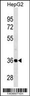 Proteasome 26S Subunit, Non-ATPase 14 antibody, 60-415, ProSci, Western Blot image 