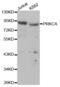 Protein Kinase C Alpha antibody, abx000652, Abbexa, Western Blot image 