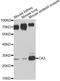 Carbonic Anhydrase 3 antibody, A13473, ABclonal Technology, Western Blot image 