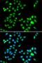 Twist Family BHLH Transcription Factor 1 antibody, LS-C346358, Lifespan Biosciences, Immunofluorescence image 