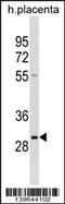 RAB22A, Member RAS Oncogene Family antibody, 60-178, ProSci, Western Blot image 