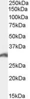 Proteasome Activator Subunit 3 antibody, EB07763, Everest Biotech, Western Blot image 