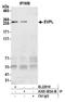 Envoplakin antibody, A305-583A-M, Bethyl Labs, Immunoprecipitation image 