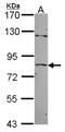 Zinc Finger Protein 148 antibody, NBP2-20964, Novus Biologicals, Western Blot image 