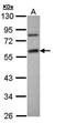 Sulfotransferase Family 1E Member 1 antibody, orb13701, Biorbyt, Western Blot image 