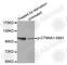 Catenin Alpha 1 antibody, AP0273, ABclonal Technology, Western Blot image 