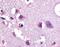 Corticotropin Releasing Hormone Receptor 1 antibody, NLS1778, Novus Biologicals, Immunohistochemistry frozen image 