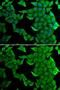 Histone methyltransferase SMYD2 antibody, GTX54717, GeneTex, Immunofluorescence image 
