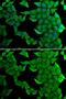 SET And MYND Domain Containing 2 antibody, GTX54717, GeneTex, Immunofluorescence image 