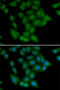 Calcium/Calmodulin Dependent Protein Kinase I antibody, 22-635, ProSci, Immunofluorescence image 