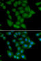 Calcium/calmodulin-dependent protein kinase type 1 antibody, 22-635, ProSci, Immunofluorescence image 