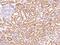 PHD Finger Protein 13 antibody, 202944-T08, Sino Biological, Immunohistochemistry paraffin image 
